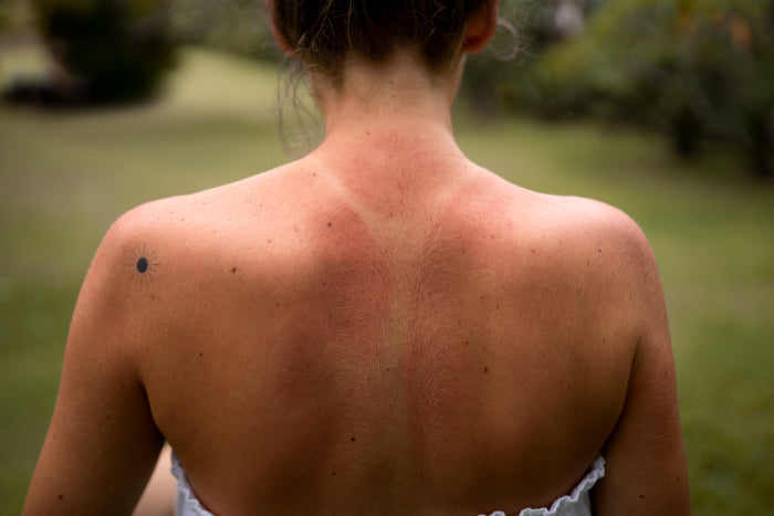What are the side effects of wearing tight bras?